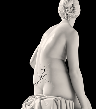 Back-pain.jpg