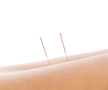 iStock_000006209299.jpg