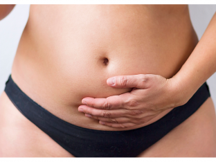 woman's bloated belly