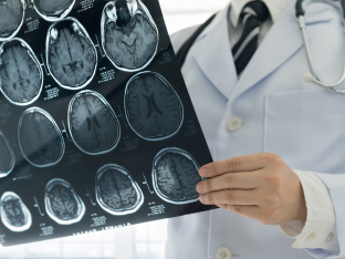 brain scan