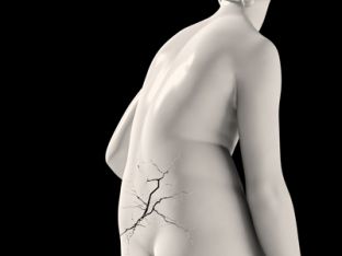 Back-pain.jpg
