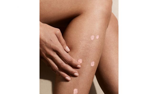 woman with calamine lotion on bug bites
